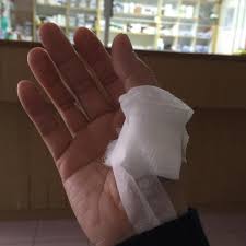 Biasanya sakit kepala sebelah kiri dapat pulih dalam beberapa jam dan tidak perlu dikhawatirkan. Sakit Ibu Jari Tangan Ahtristis Kah Aku Cerita Budak Sepet