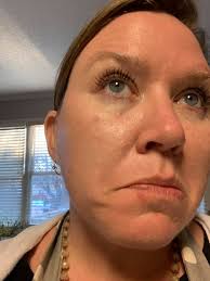 Why does biting your lip hurt