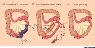 Though the jejunum and the ileum are parts of the small intestine, anatomically they have a slight difference. Small Intestinalization Of Colon Using Ileum Organoids Trends In Cell Biology