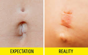 How much did it cost? 12 Myths About Piercing It S Time You Stopped Believing