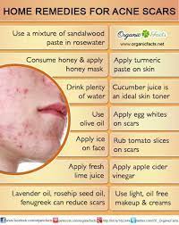 Pin On Natural Skin Care