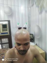 List of nearest Physiotherapists For Traction Therapy in Solan