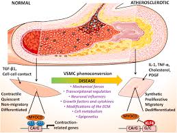 They are spindle shaped and have no striations. Targeting The Phenotypic Switch Of Vascular Smooth Muscle Cells To Tackle Atherosclerosis Atherosclerosis