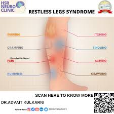 Image result for Restless Leg Syndrome