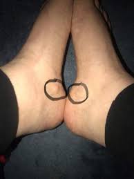 Beule An Beiden Fussen Normal Fusse
