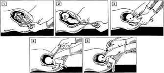 Like the suffering of aborted babies, their suffering so often remains hidden—even from themselves. Pictures Of Aborted Babies Wisconsin Right To Life