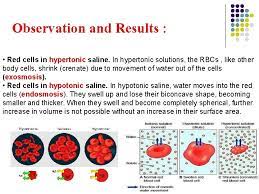 The red blood cell is hypotonic and the concentrated sugar solution is hypertonic. Osmotic Fragility Test Physiology Lab4 Osmosis L Osmosis