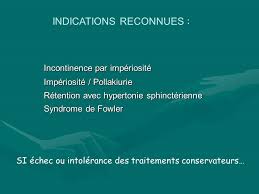 L'incontinence par impériosité est due à des contractions vésicales involontaires. L Incontinence Urinaire Ppt Telecharger