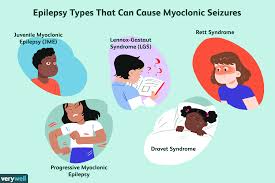 During a seizure, there are bursts of electrical activity in your brain, sort of like an electrical storm. Myoclonic Epilepsy Symptoms Causes Diagnosis And Treatment