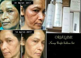 Bali alus cream face cooling down adalah salah satu skincare untuk menghilangkan flek hitam pada wajah. Hilangkan Flek Hitam Membandel Dengan Novage Bright Sublime Set Skincare Set Dari Oriflame Dibuat Dari B Kosmetik Alami Perawatan Kulit Perawatan Kulit Alami