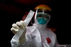 Laboratorium Rapid Test Covid 19 Rspad Siap Beroperasi Bipol Co