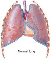 Sihoe a., filosso p., cusumano g., lococo f., melfi f. Closed Pneumothorax Definition Of Closed Pneumothorax By Medical Dictionary