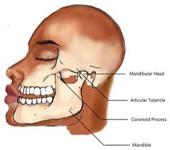 Image result for Jaw Dislocation
