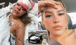 Browse 410 dead bodies in car accident photos stock photos and images available or start a new search to explore more stock photos and images. Beautician Shares Message From Client Involved In Car Crash Whose Eyelashes Held Up During Accident Daily Mail Online