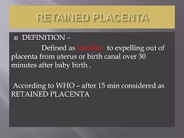 Image result for Retained Placenta
