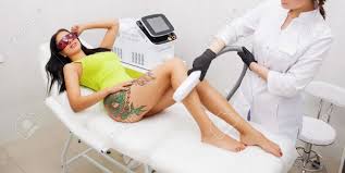 Laser hair removal and electrology are safe and effective means to remove unwanted hair. Laser Epilation And Cosmetology In Beauty Salon Hair Removal Procedure Laser Epilation Cosmetology Spa And Hair Removal Concept Beautiful Brunette Woman Getting Hair Removing On Body Stock Photo Picture And Royalty Free