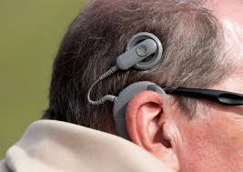 Image result for Cochlear Implant