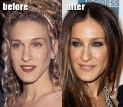 Page Not Found Celebrity Plastic Surgery Pictures Sarah Jessica Parker Plastic Surgery Plastic Surgery Pictures