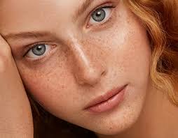 Freckles Retouch Projects :: Photos, videos, logos, illustrations and  branding :: Behance