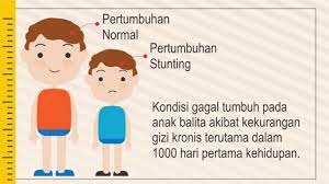 Artinya, ketika seorang anak sudah stunting sejak masih balita, pertumbuhannya akan terus lambat hingga ia dewasa. Bkkbn Sulteng Cegah Stunting Luncurkan Program 1000 Hari Pertama Kehidupan 50detik