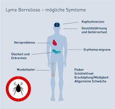 Daher ist eine herzmuskelentzündung nicht leicht zu erkennen. Borreliose Symptome Verlauf Behandlung