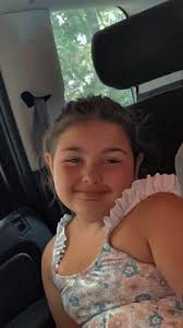 We don't like our braces but they work wonders!