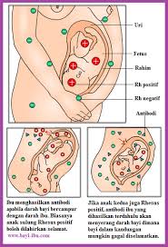 Ketidakserasian Darah Rhesus Negatif Ibu Hamil Rhesus Positif Bayi Projects To Try Cards Projects