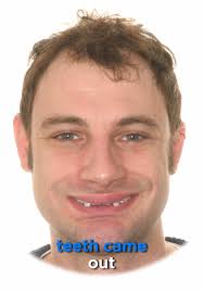 Accident Eric Brunson