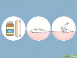 Add a few drops of dish soap to a cup of water and just hose them down. 3 Ways To Remove Cactus Needles Wikihow
