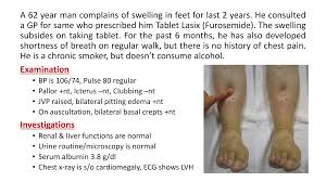 Image result for Edema Exam