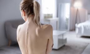 Les femmes ainsi que les personnes qui travaillent dans un bureau sont plus sujets à subir des douleurs dans le haut du dos à cause des disques qui se déplacent. Mal Au Dos A Gauche Comprendre Et Soulager Cette Douleur Reflex Osteo