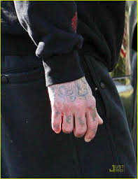 Travis barker recalls the deadly plane crash that changed his life forever: Full Sized Photo Of Travis Barker Post Crash Pictures 03 Photo 1503381 Just Jared