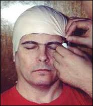 Face Lifecasting: fxwarehouse.com