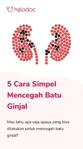 Batu ginjal adalah kondisi yang ditandai dengan terbentuknya kristal mineral dan garam sehingga menjadi keras atau menyerupai batu di dalam ginjal. Ketahui Ini Gejala Awal Munculnya Batu Ginjal