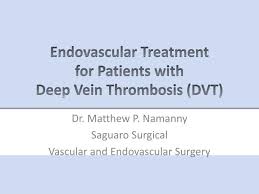 A number of treatment regimens are now available for acute dvt. Ppt Endovascular Treatment For Patients With Deep Vein Thrombosis Dvt Powerpoint Presentation Id 3418485