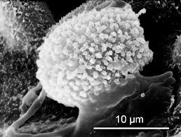 Image result for didymascella thujina