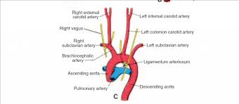 Image result for carotid artery