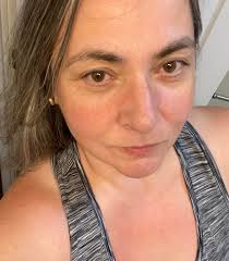 Struggling with autoimmune, Lyme and possible mold issues. Does anyone know  of any knowledgeable people or holistic practices that have had success  actually helping people? I've seen so many people, have spent