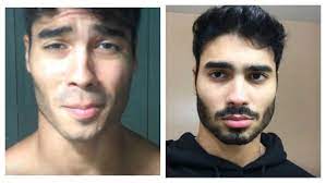 Combining nutrients like biotin and niacin with natural ingredients like argan oil, caffeine, pomegranate extract and black caster oil, maxx beard helps to soften your facial hair while also promoting new growth. Does Using Testosterone Or Biotin Pills Tablets Help You Grow Facial Hair Quora