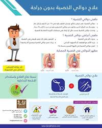 علاج دوالي الخصية بدون جراحه مركز دار الخبرة للأشعة التداخلية Interventional Radiology Radiology Egypt