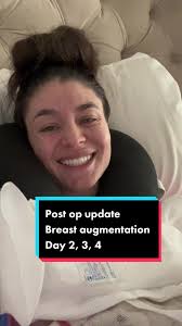 Day 23 and 24 Mommy Makeover Surgery Recap