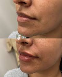 LYOS Plastic Surgery & Associates