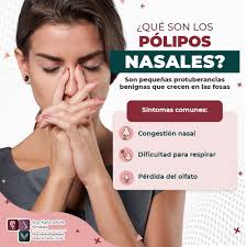 🤧 ¿Qué son los pólipos nasales? 🤧 Son crecimientos benignos en la mucosa  nasal que pueden causar: 🔹 Congestión nasal constante 🏥 🔹 Dificultad  para respirar 😮‍💨 🔹 Pérdida del olfato 👃