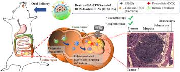 Hypothyroidism (reduced function of the thyroid) is very common in systemic scleroderma because of either fibrosis of the thyroid or thyroid autoimmune disorder. Hierarchically Targetable Polysaccharide Coated Solid Lipid Nanoparticles As An Oral Chemo Thermotherapy Delivery System For Local Treatment Of Colon Cancer Sciencedirect