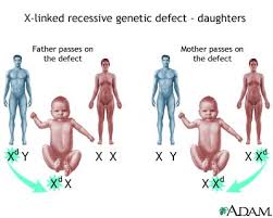 Explain why a trait is. X Linked Recessive Genetic Defects How Girls Are Affected Medlineplus Medical Encyclopedia Image