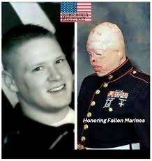 Marine Cpl. Donald M. Marler Died June 6, 2010 Serving During Operation  Enduring Freedom 22, of St. Louis; assigned to the 3rd Battalion, 1st  Marine Regiment, 1st Marine Division, I Marine Expeditionary