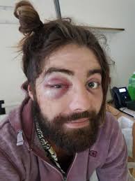 2 footed, wonderful balance, has the eye for a pass and. Man Coward Punched Blinded Over Bad Haircut Queensland Times