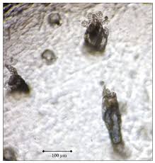 Image result for Demodex folliculorum
