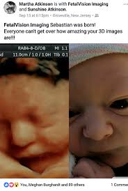 When should i get a 3d ultrasound. 3d Ultrasound 4d Ultrasound Philadelphia Pa New Jersey