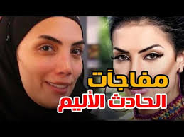 حساب سعر السلع كم يصبح بعد الخصم وايضاً يمكن حساب كم كان سعر السلعة قبل الخصم. ØªÙØ§ØµÙŠÙ„ Ø§Ù„Ø­Ø§Ø¯Ø« Ø§Ù„Ø°ÙŠ Ø£Ø¯Ù‰ Ù„ØªØ´ÙˆÙ‡ Ø£Ù†Ù Ø­ÙˆØ±ÙŠØ© ÙØ±ØºÙ„ÙŠ 3 Ø³Ù†ÙˆØ§Øª Ø¨Ø¯ÙˆÙ† Ø­Ø§Ø³Ø© Ø´Ù… Youtube